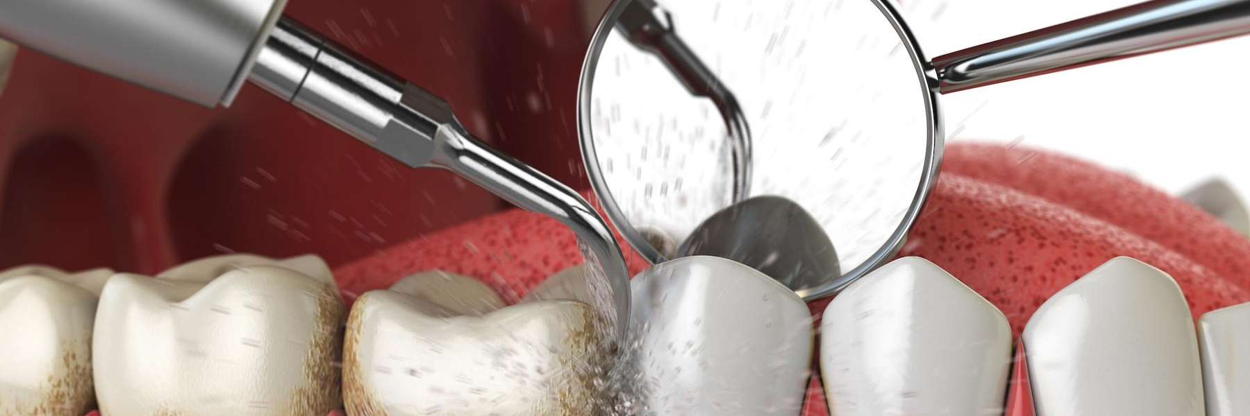 close up of dental tools | winston salem nc dentist