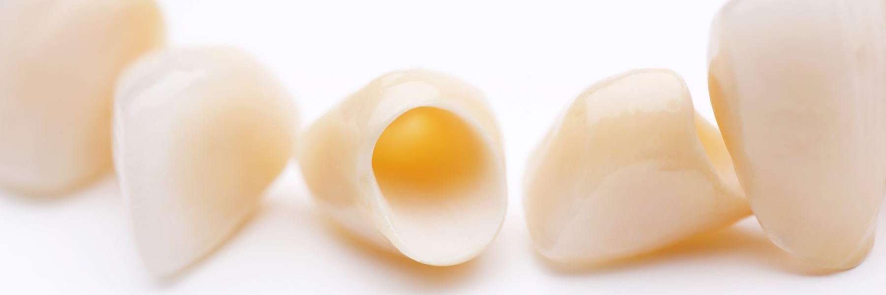 close up of dental. crowns | dentist winston salem north carolina